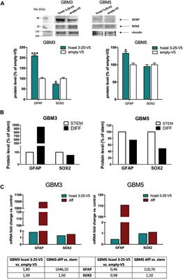 Expression of calpastatin hcast 3-25 and activity of the calpain/calpastatin system in human glioblastoma stem cells: possible involvement of hcast 3-25 in cell differentiation